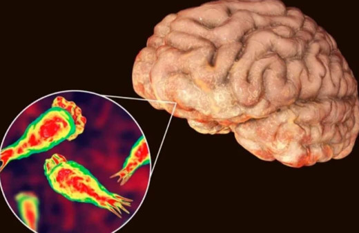 Burundan girip insan beynini yiyor! Beyin yiyen amip aylar sonra yeniden hortladı