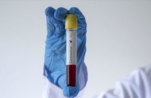 Kırklareli Valisi Osman Bilgin'den korkutan açıklama: En kötü aydan daha kötü durumdayız