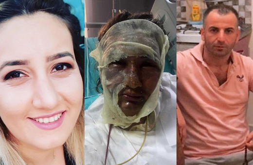 İstanbul'da yüzünü kızgın yağla yakan sevgilisi tutuklanınca affedin diye ağladı