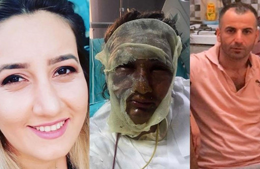 Yüzüne kızgın yağ döküp öldürmek isteyen erkek arkadaşı ceza alınca 'bırakın onu' diye ağladı