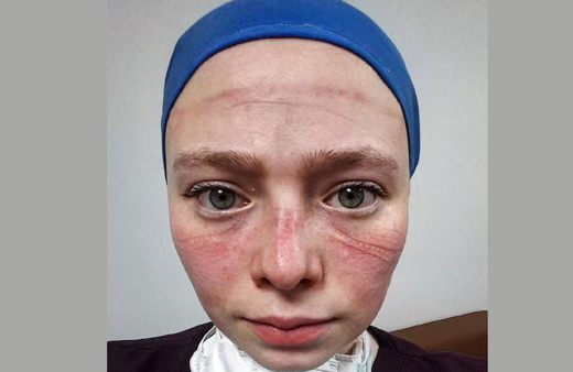 Trabzon'da yoğun bakım servisinde görevli! Seher Altuncu'nun 'maske izli' fotoğrafı sosyal medyayı salladı