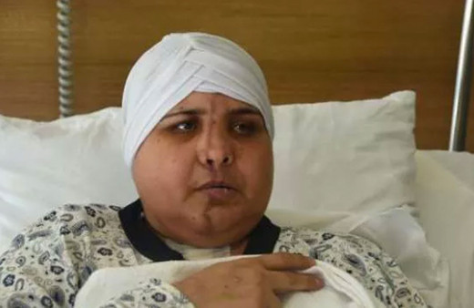 Eskişehir'de inanılmaz olay! Yüzü ikiye ayrılan kadının yüzü ameliyatla birleştirildi