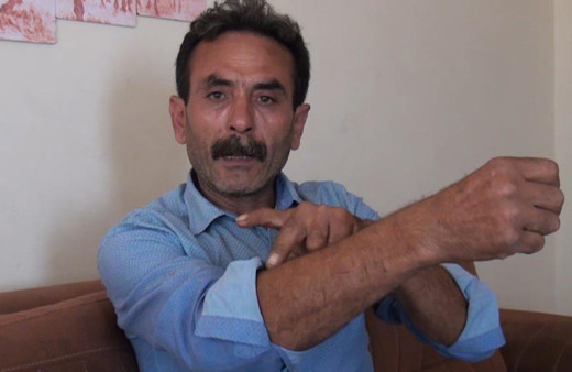 Aydın'da yaşadığı travmayı unutamıyor beslediği pitbull'un saldırdığı adam: Silahtan farkı yok