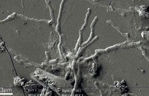 İtalya’da 2 bin yıl önceye ait kafatasından sağlam beyin hücresi keşfedildi