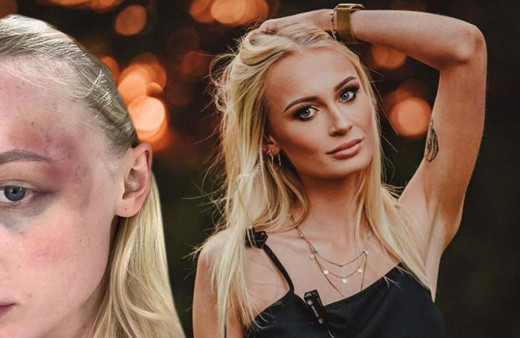 Kendi ifşa etti! Belçikalı manken Anthonia Rochus, sevgilisinden 20 kez şiddet görmüş