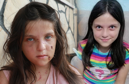 Samsun'da kabus dolu 5 dakika! 12 yaşındaki Tuğba yaşadığı tramvayı atlatamıyor