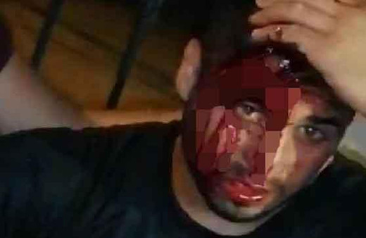 Hatay'da gergin gece! Sigara için çakmağını çaktı ‘kundakçı’ diye dayak yedi