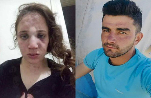 Aydın'da akılalmaz işkence! 3 çocuk annesi kadını bu hale getirdi!