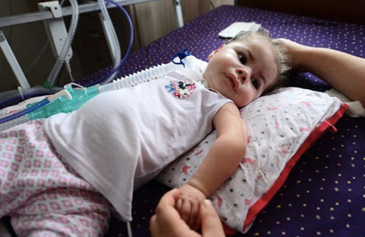 SMA nedir neden olur SMA hastalığı belirtileri nelerdir?