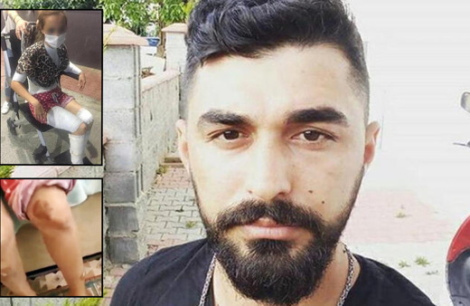 İstanbul'da kızgın bıçakla eşini yakıp zorla ilişkiye girdi! Anlattıkları kan dondurdu