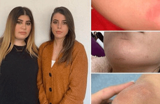 Fransa'nın Meziers bölgesinde iki Türk kadına alçak saldırı