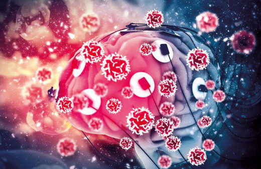 Prof. Dr. Osman Osman Müftüoğlu: Covid-19 zekayı etkiliyor