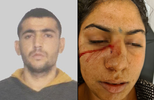 Adana'da eşine kafa atıp burnunu bıçakladı! Sebebi ise bakın ne