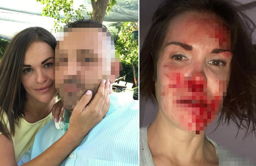 Ankara'da Rus eşe öldüresiye dayak terörü! Banyoya soktu kanlar içinde bıraktı