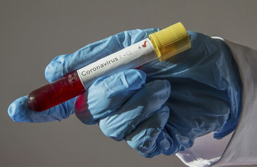 Başakşehir'de bir futbolcunun koronavirüs test sonucu pozitif çıktı