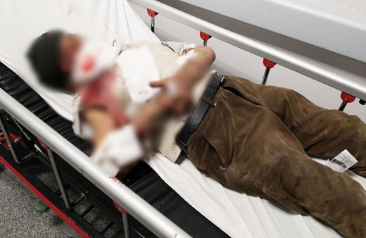 Aksaray'da misafirliğe giden adama köpek saldırdı! Vücudunu parçaladı