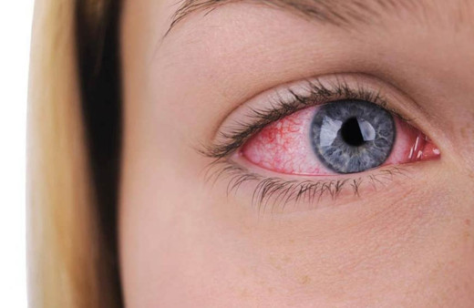 Doç. Dr. Ceyhun Arıcı: Koronavirüs sadece göz kızarıklığıyla da sinyal verebilir