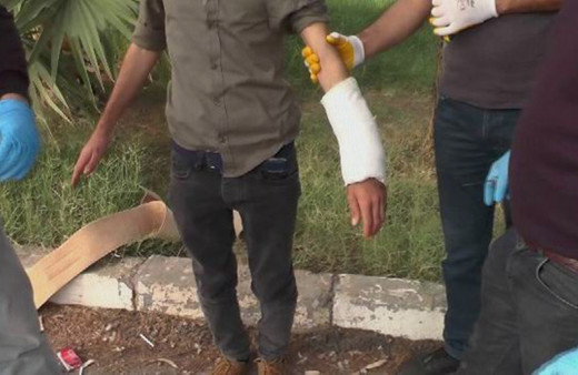 Mardin'de bombayı kolundaki alçıda kamufle eden terörist yakalandı