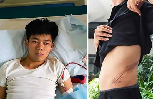 Çin'de İPhone almak için böbreğini satan genç yatalak kaldı