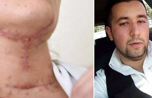 Avcılar'da sevgilisinin boğazını kesip cinsel saldırıda bulunan cani: Olay abartılıyor