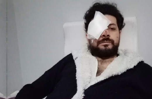 Maganda kuruşunuyla gözünü kaybeden Şahan Dinç dehşet anlarını anlattı