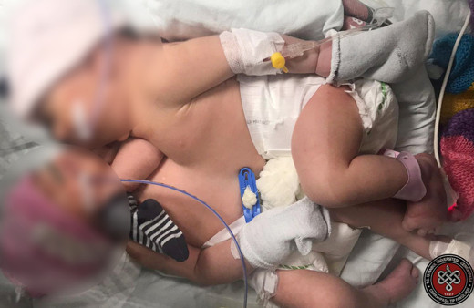 21 yıl aradan sonra ikinci kez yapıldı! Cerrahpaşa'da zorlu operasyon 11 saat sürdü