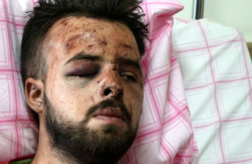 Trabzon'da 19 yaşındaki genç bu hale geldiği feci kazayı anlattı: Ben atlayamadım