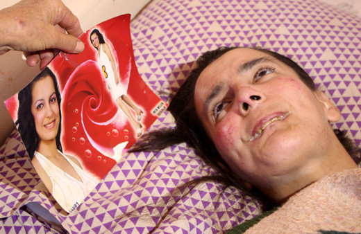 Adana'da damadı 'astım ilacı' diye verdi kızı tanınmaz hale geldi