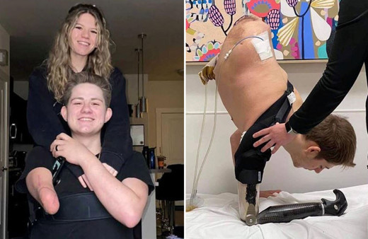 Vücudunun yarısını kaybetti doktorlar 6 kez 'yaşamaz' dedi o hayata tutundu