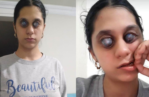 Balıkesir'de genç Ümran'ı görenler gözlerine inanamıyor 'photoshop' diyorlar