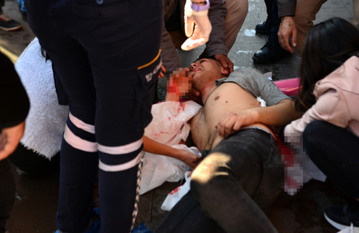 Adana Seyhan'da iki kardeş kavgada yaralandı