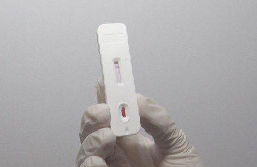 Uzmanlardan evde hızlı Kovid testi yapanlara uyarı: Kovid teşhisi için kullanılamaz