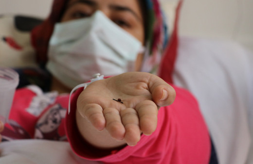 Aydın'da 17 yıllık şok gerçek! Bebekken yuttuğu toplu iğneyle bağırsağı delik yaşadı