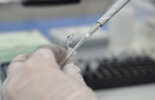 PCR testi nedir kimlere yapılır sonucu kaç güne çıkar?