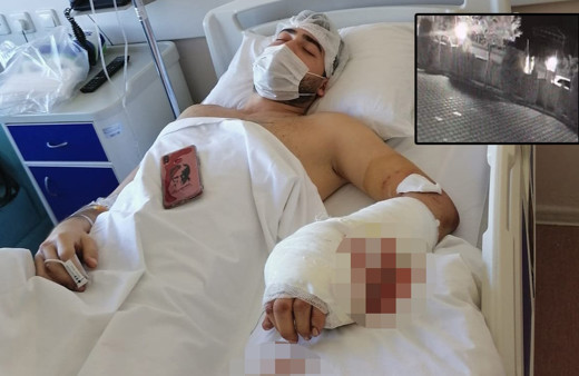 Bursa'ya çocuğunu görmeye gitti bu hale geldi! Dehşet anı kamerada