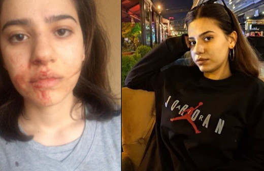 İzmir'de ağabeyi tarafından bu hale getirildi: Burnumu kırdı, yere atarak...