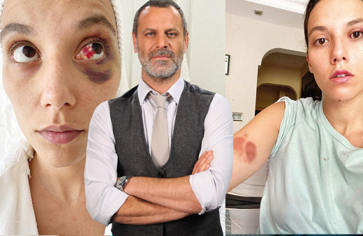 Deniz Bulutsuz 'bu sorular iyi olmuyor' dedi kameralara saldırdı! Ozan Güven darp etmişti