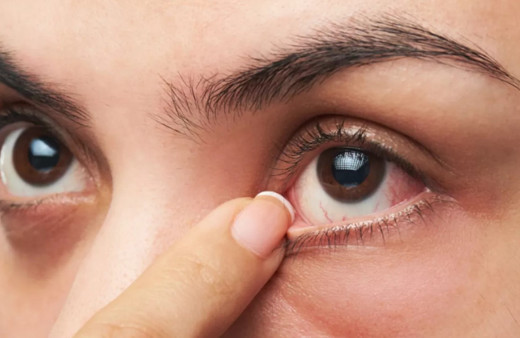 Uzman isim uyardı! Gözlerde kızarıklık varsa tehlike sinyalleri çalışıyor