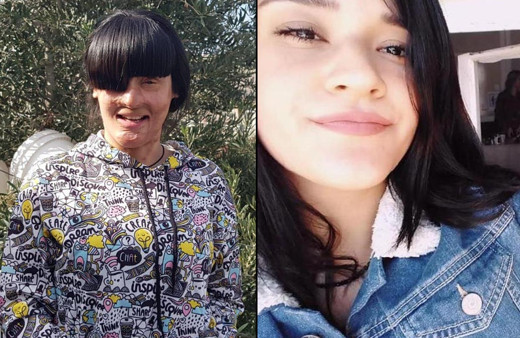 Hatay'da genç kızın hayatı kabusa döndü! Göz kapakları ve dudağı yeniden yapıldı