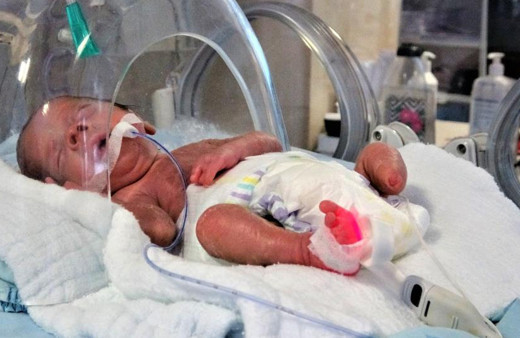 Tokat'ta parmak bebek ayaksız olarak dünyaya geldi hayata tutundu