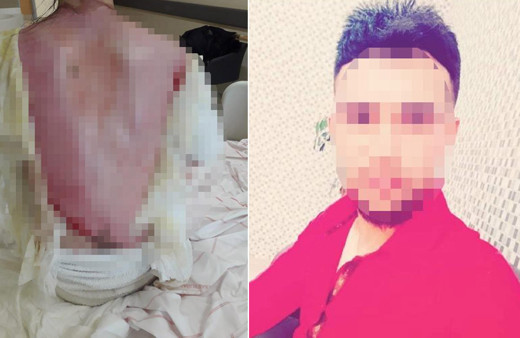 Konya'da eşinin ve 1,5 yaşındaki kızının üzerine kaynar su dökmüştü! 'Kazara oldu' dedi