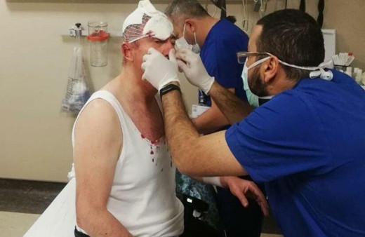 Selçuk Özdağ’a saldıranların ifadeleri ortaya çıktı