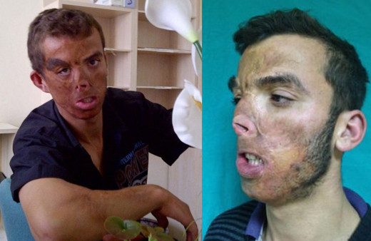 Türkiye'de bir ilkti Antalya'da yapılmıştı! 9 yıl sonraki hali görenleri şaşırttı