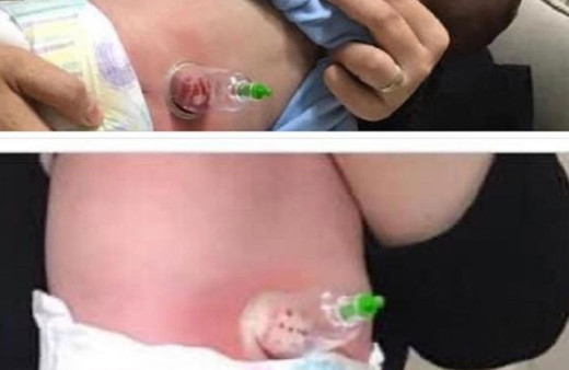 Bebeklere 'hacamat' görüntüleri tartışma yarattı! Uzmanından uyarı