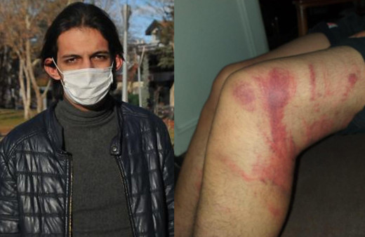 Konya'da ustası triger kayışıyla dayak atmıştı! 'Dayak yediğimle kaldım' dedi