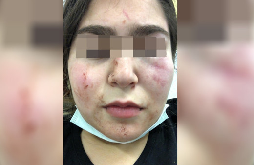 Alman polisi Türk baba ile kızına şiddet uyguladı