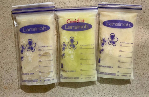 Meksika'da koronavirüse yakalanan annenin sütü yeşile döndü