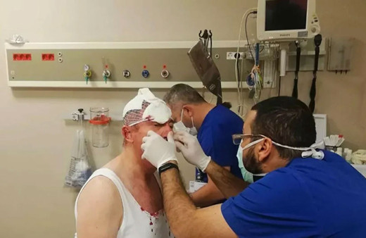 Selçuk Özdağ'a saldıran 5 kişi tahliye edildi