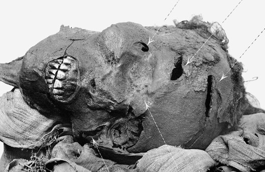 Firavunun tomografisi çekildi eski mumyacıların gizlemeye çalıştığı gerçek dehşete düşürdü