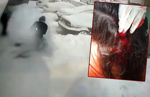 İstanbul Ataşehir'de pitbull saldırısına uğrayan küçük kız kanlar içinde kaldı